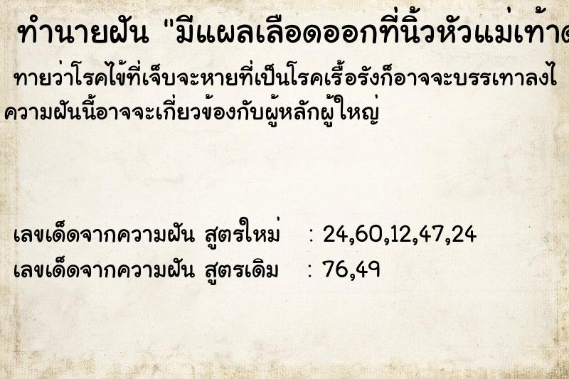 ทำนายฝันทำนายฝันมีแผลเลือดออกที่นิ้วหัวแม่เท้าด้านซ้ายและที่แขน
