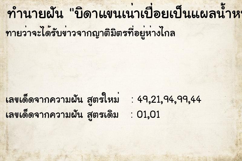 ทำนายฝันทำนายฝันบิดาแขนเน่าเปื่อยเป็นแผลน้ำหนอง