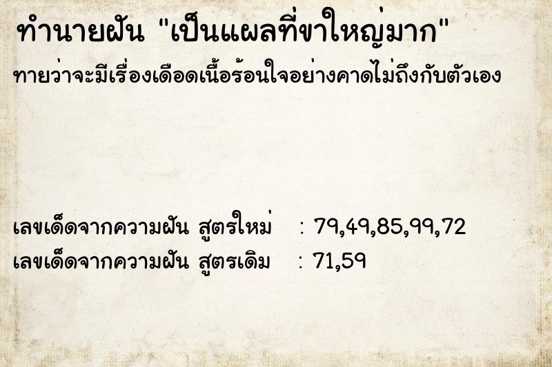 ทำนายฝันเป็นแผลที่ขาใหญ่มาก ทำนายฝันทำนายฝันเป็นแผลที่ขาใหญ่มาก