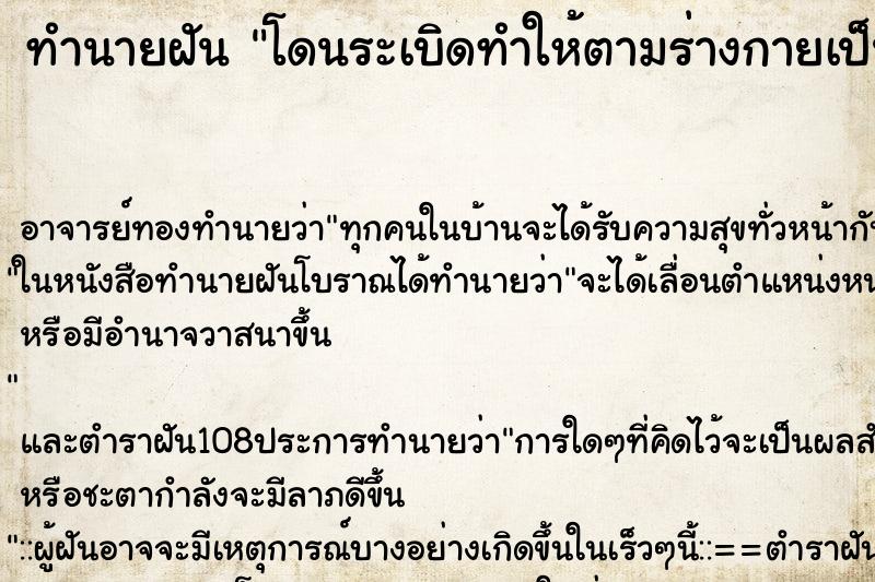 ทำนายฝัน โดนระเบิดทำให้ตามร่างกายเป็นแผล ทำนายฝัน โดนระเบิดทำให้ตามร่างกายเป็นแผล