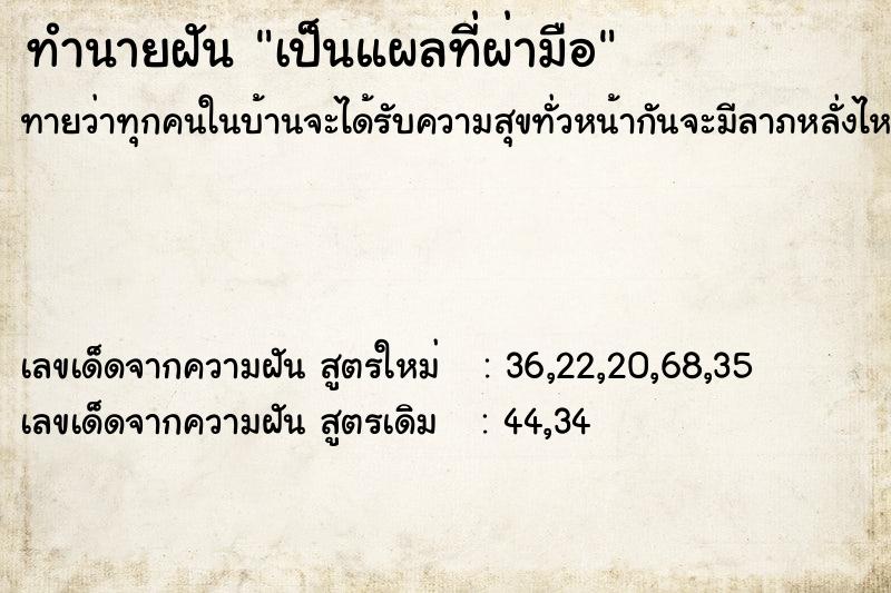 ทำนายฝัน เป็นแผลที่ผ่ามือ ทำนายฝัน เป็นแผลที่ผ่ามือ