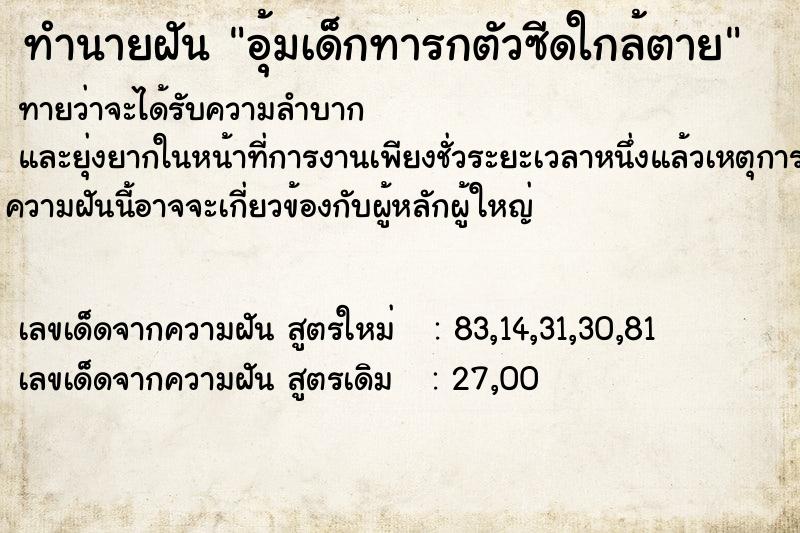 ทำนายฝันทำนายฝันอุ้มเด็กทารกตัวซีดใกล้ตาย