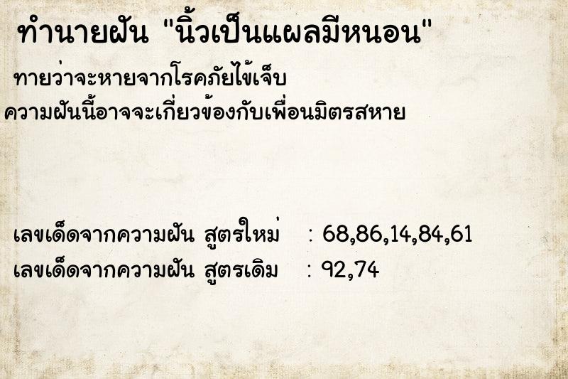ทำนายฝันทำนายฝันนิ้วเป็นแผลมีหนอน