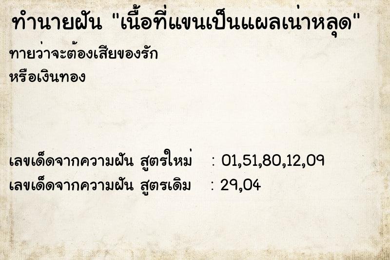 ทำนายฝัน เนื้อที่แขนเป็นแผลเน่าหลุด ทำนายฝัน เนื้อที่แขนเป็นแผลเน่าหลุด