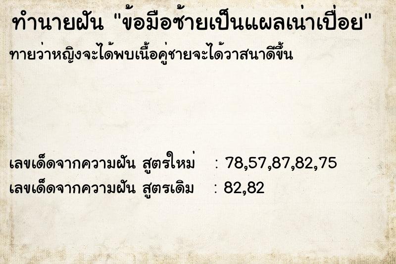 ทำนายฝันข้อมือซ้ายเป็นแผลเน่าเปื่อย ทำนายฝันทำนายฝันข้อมือซ้ายเป็นแผลเน่าเปื่อย