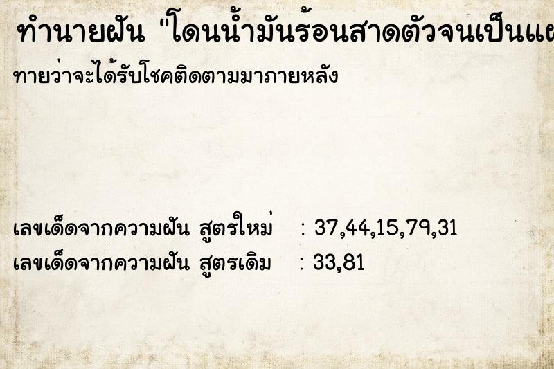 ทำนายฝันทำนายฝันโดนน้ำมันร้อนสาดตัวจนเป็นแผล