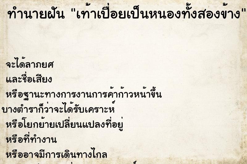 ทำนายฝัน เท้าเปื่อยเป็นหนองทั้งสองข้าง ทำนายฝัน เท้าเปื่อยเป็นหนองทั้งสองข้าง