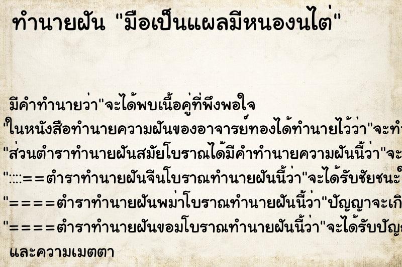 ทำนายฝันมือเป็นแผลมีหนองนไต่ ทำนายฝันทำนายฝันมือเป็นแผลมีหนองนไต่