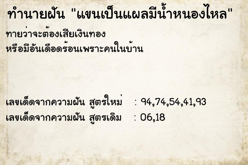 ทำนายฝันทำนายฝันแขนเป็นแผลมีน้ำหนองไหล