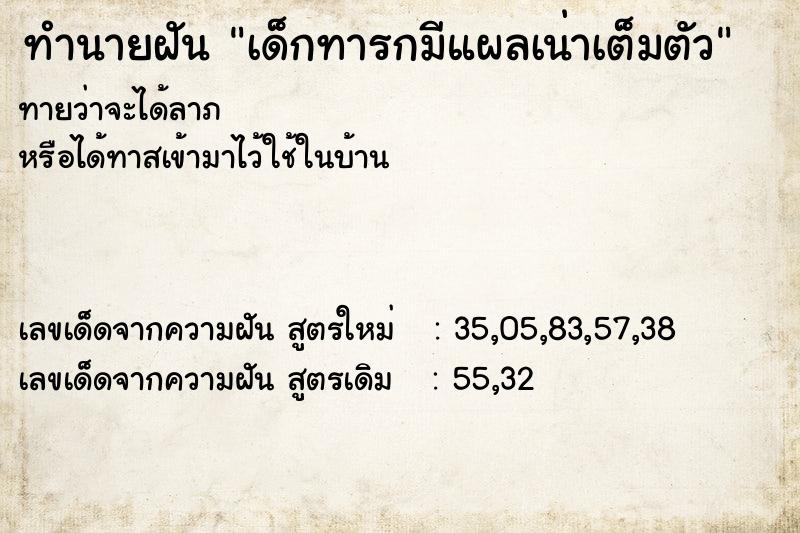 ทำนายฝันทำนายฝันเด็กทารกมีแผลเน่าเต็มตัว