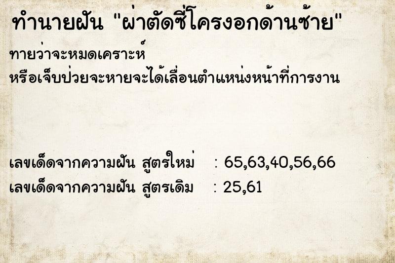 ทำนายฝันทำนายฝันผ่าตัดซี่โครงอกด้านซ้าย