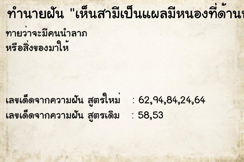 ทำนายฝันทำนายฝันเห็นสามีเป็นแผลมีหนองที่ด้านหลัง