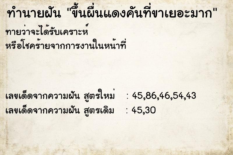 ทำนายฝันขึ้นผื่นแดงคันที่ขาเยอะมาก ทำนายฝันทำนายฝันขึ้นผื่นแดงคันที่ขาเยอะมาก