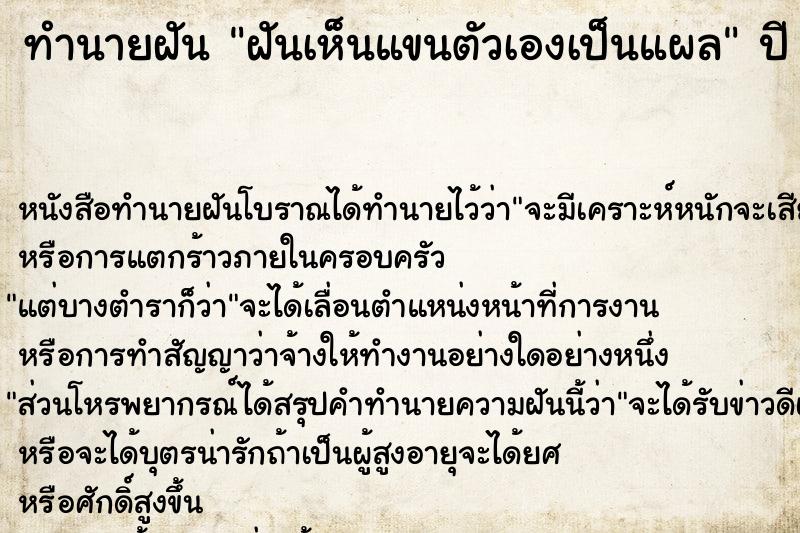 ทำนายฝันฝันเห็นแขนตัวเองเป็นแผล ทำนายฝันทำนายฝันฝันเห็นแขนตัวเองเป็นแผล