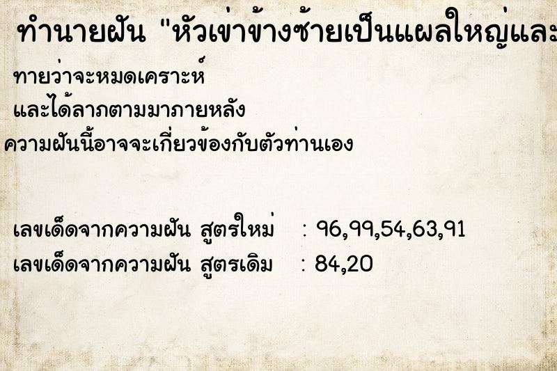 ทำนายฝัน หัวเข่าข้างซ้ายเป็นแผลใหญ่และลึก ทำนายฝัน หัวเข่าข้างซ้ายเป็นแผลใหญ่และลึก