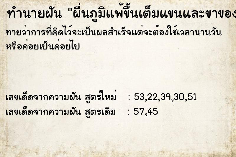 ทำนายฝันผื่นภูมิแพ้ขึ้นเต็มแขนและขาของตัวเอง ทำนายฝันทำนายฝันผื่นภูมิแพ้ขึ้นเต็มแขนและขาของตัวเอง