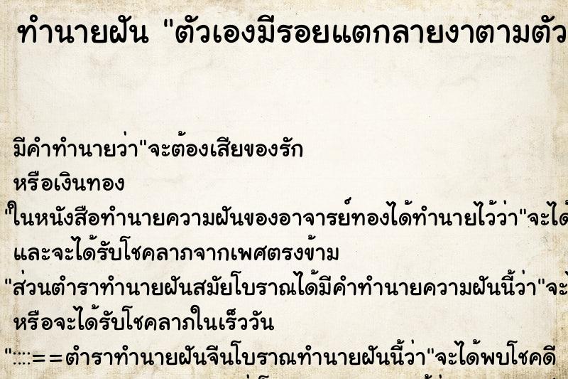 ทำนายฝันตัวเองมีรอยแตกลายงาตามตัวคล้ายเกล็ดงู ทำนายฝันทำนายฝันตัวเองมีรอยแตกลายงาตามตัวคล้ายเกล็ดงู