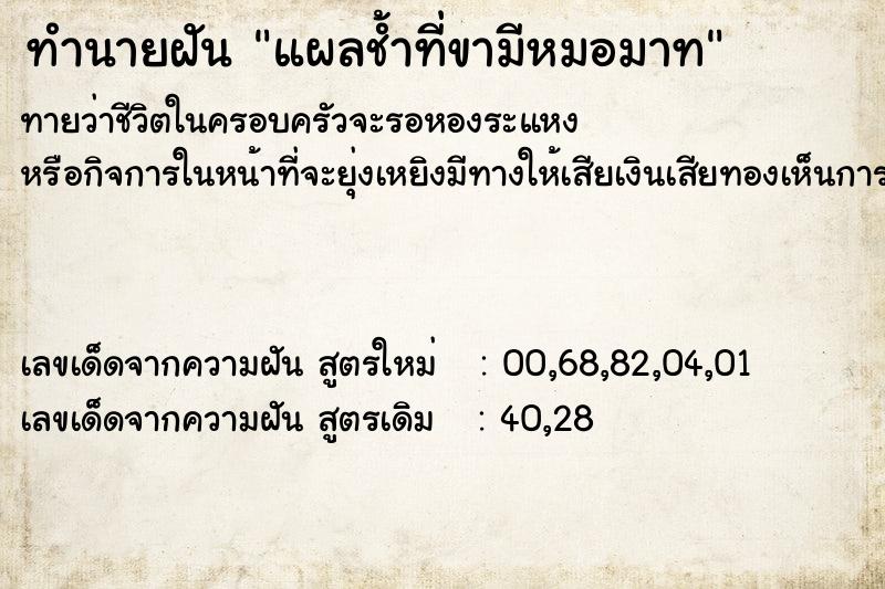 ทำนายฝัน แผลช้ำที่ขามีหมอมาท ทำนายฝัน แผลช้ำที่ขามีหมอมาท