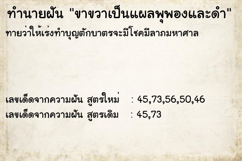 ทำนายฝันขาขวาเป็นแผลพุพองและดำ ทำนายฝันทำนายฝันขาขวาเป็นแผลพุพองและดำ
