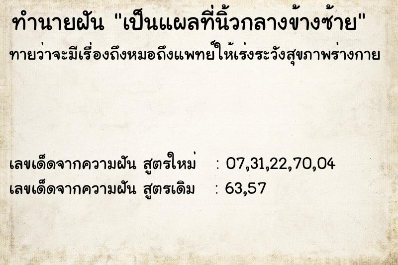 ทำนายฝันทำนายฝันเป็นแผลที่นิ้วกลางข้างซ้าย