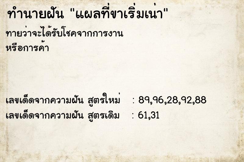 ทำนายฝันทำนายฝันแผลที่ขาเริ่มเน่า