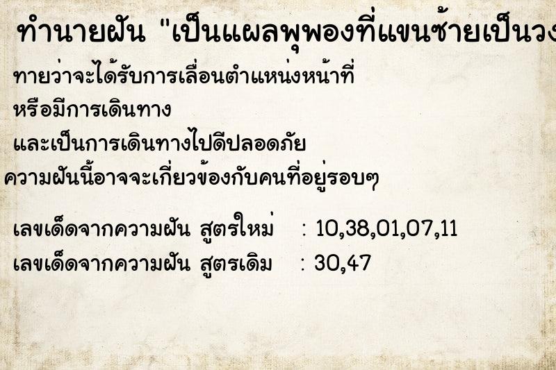 ทำนายฝันทำนายฝันเป็นแผลพุพองที่แขนซ้ายเป็นวงกลมรอบแขน3วง