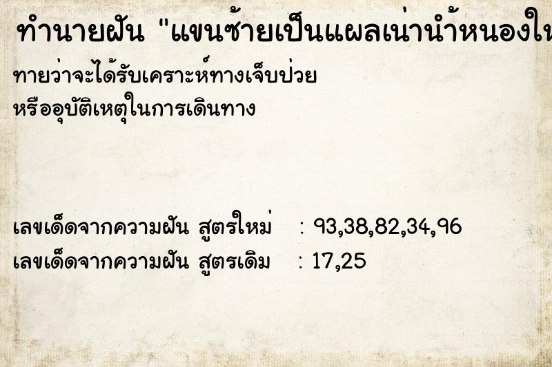 ทำนายฝันทำนายฝันแขนซ้ายเป็นแผลเน่านำ้หนองใหล