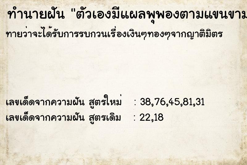 ทำนายฝัน ตัวเองมีแผลพุพองตามแขนขามากมาย ทำนายฝัน ตัวเองมีแผลพุพองตามแขนขามากมาย