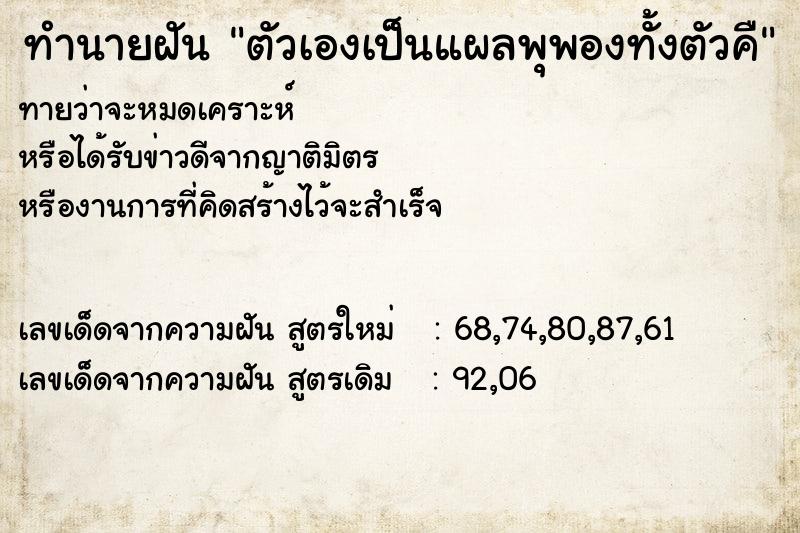 ทำนายฝัน ตัวเองเป็นแผลพุพองทั้งตัวคื ทำนายฝัน ตัวเองเป็นแผลพุพองทั้งตัวคื