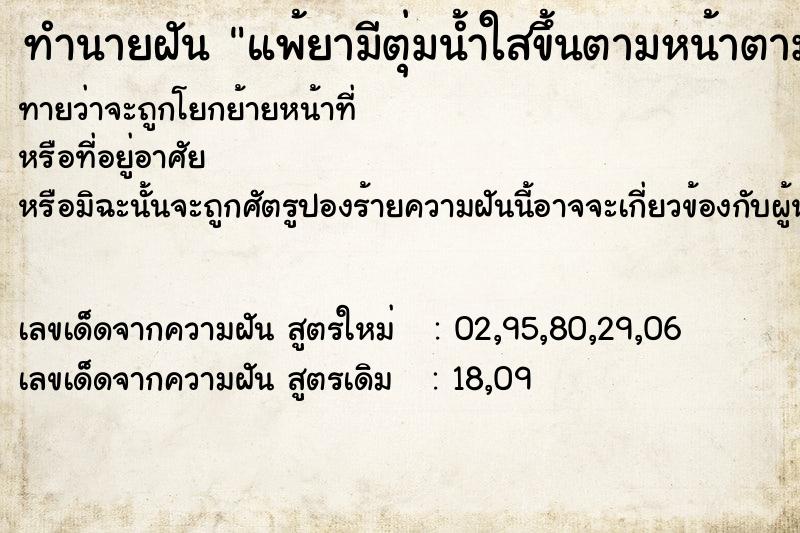 ทำนายฝันทำนายฝันแพ้ยามีตุ่มน้ำใสขึ้นตามหน้าตามเเขน