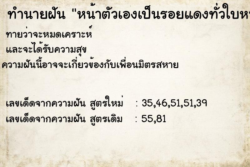 ทำนายฝัน หน้าตัวเองเป็นรอยแดงทั่วใบหน้า ทำนายฝัน หน้าตัวเองเป็นรอยแดงทั่วใบหน้า