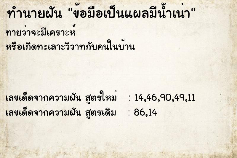 ทำนายฝันข้อมือเป็นแผลมีน้ำเน่า ทำนายฝันทำนายฝันข้อมือเป็นแผลมีน้ำเน่า