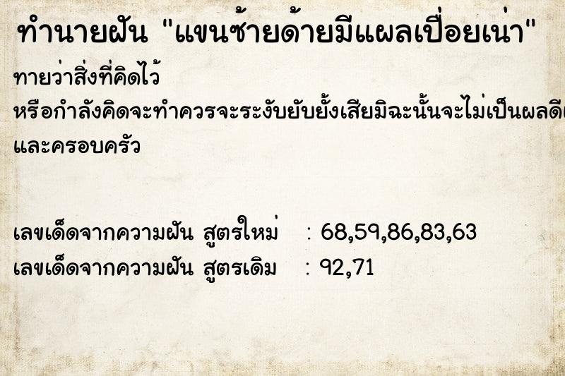ทำนายฝันแขนซ้ายด้ายมีแผลเปื่อยเน่า ทำนายฝันทำนายฝันแขนซ้ายด้ายมีแผลเปื่อยเน่า