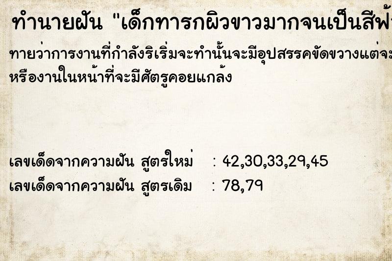 ทำนายฝันทำนายฝันเด็กทารกผิวขาวมากจนเป็นสีฟ้า