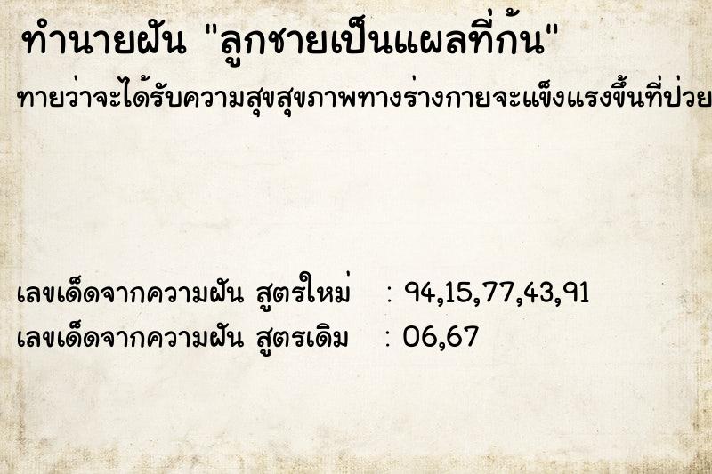 ทำนายฝัน ลูกชายเป็นแผลที่ก้น ทำนายฝัน ลูกชายเป็นแผลที่ก้น