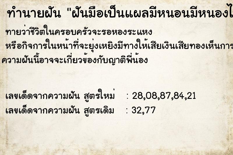 ทำนายฝันฝันมือเป็นแผลมีหนอนมีหนองไหล ทำนายฝันทำนายฝันฝันมือเป็นแผลมีหนอนมีหนองไหล