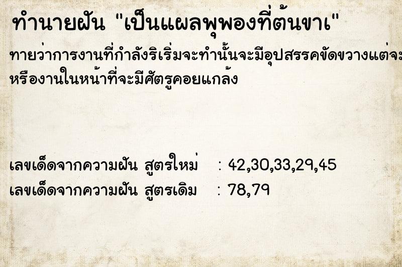 ทำนายฝันทำนายฝันเป็นแผลพุพองที่ต้นขาà