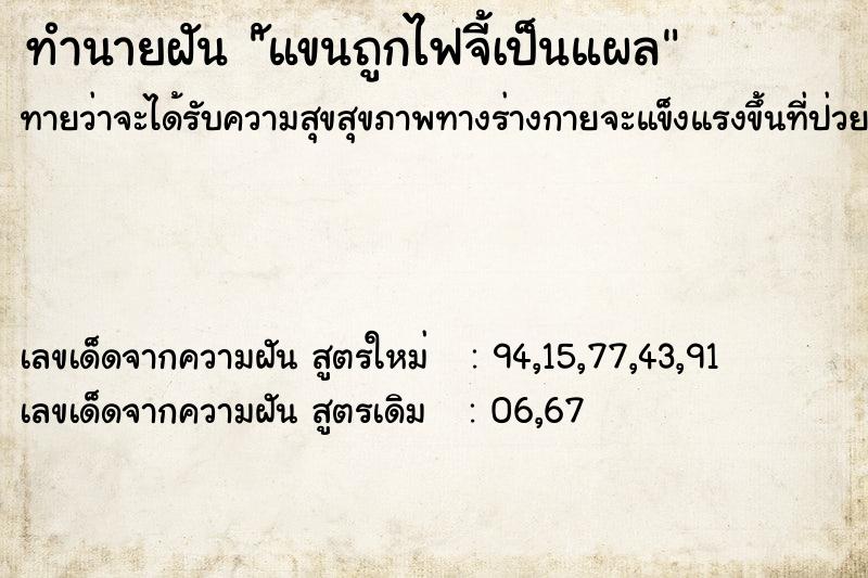 ทำนายฝันทำนายฝันัแขนถูกไฟจี้เป็นแผล