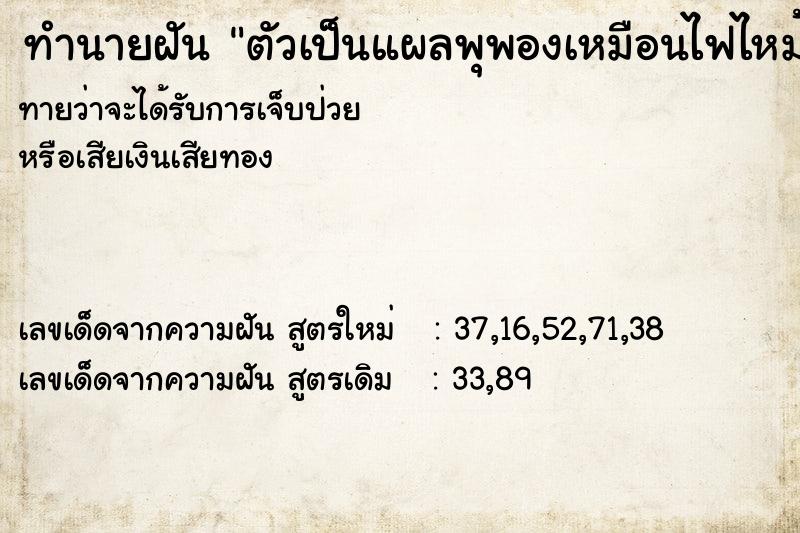 ทำนายฝัน ตัวเป็นแผลพุพองเหมือนไฟไหม้ ทำนายฝัน ตัวเป็นแผลพุพองเหมือนไฟไหม้