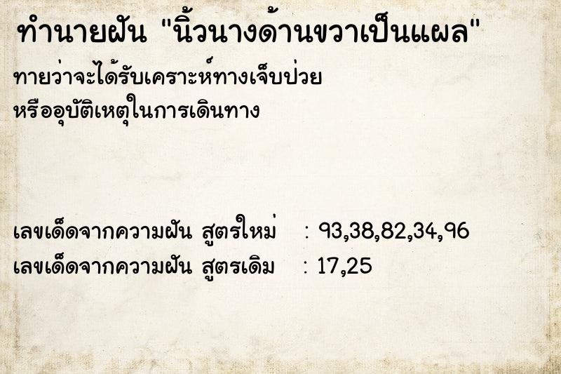 ทำนายฝันนิ้วนางด้านขวาเป็นแผล ทำนายฝันทำนายฝันนิ้วนางด้านขวาเป็นแผล
