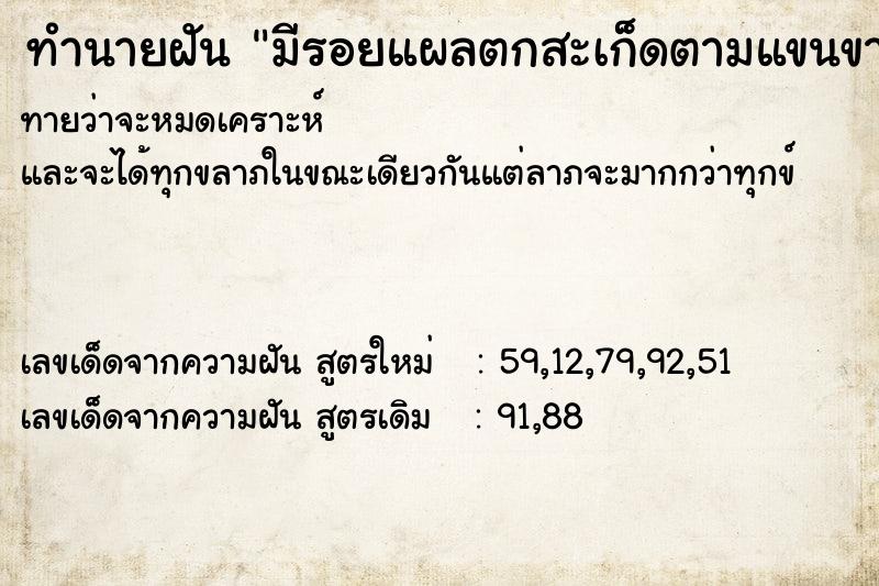 ทำนายฝันมีรอยแผลตกสะเก็ดตามแขนขาหน้าอกและทำให้ตกใจ ทำนายฝันทำนายฝันมีรอยแผลตกสะเก็ดตามแขนขาหน้าอกและทำให้ตกใจ