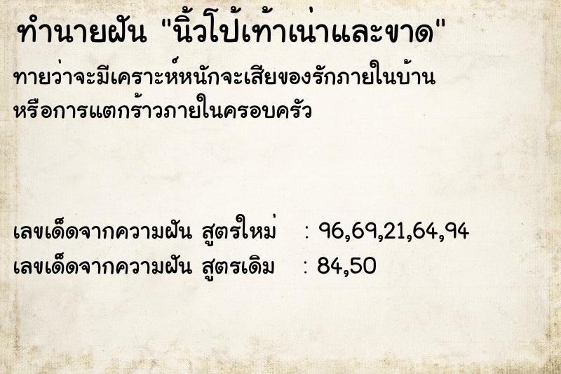 ทำนายฝันนิ้วโป้เท้าเน่าและขาด ทำนายฝันทำนายฝันนิ้วโป้เท้าเน่าและขาด