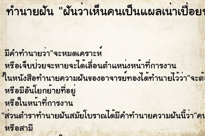 ทำนายฝัน ฝันว่าเห็นคนเป็นแผลเน่าเปื่อยทั้งตัว ทำนายฝัน ฝันว่าเห็นคนเป็นแผลเน่าเปื่อยทั้งตัว