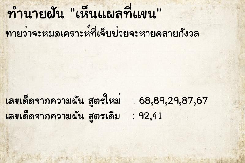 ทำนายฝันทำนายฝันเห็นแผลที่แขน