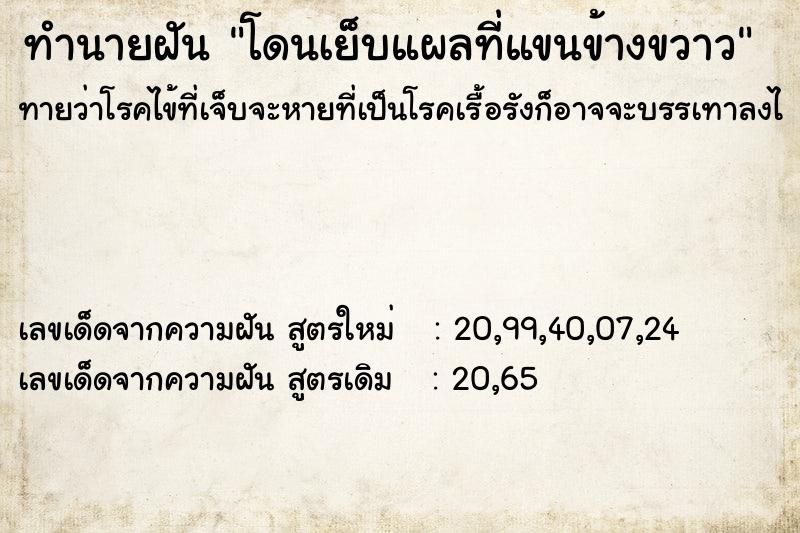 ทำนายฝันทำนายฝันโดนเย็บแผลที่แขนข้างขวาว