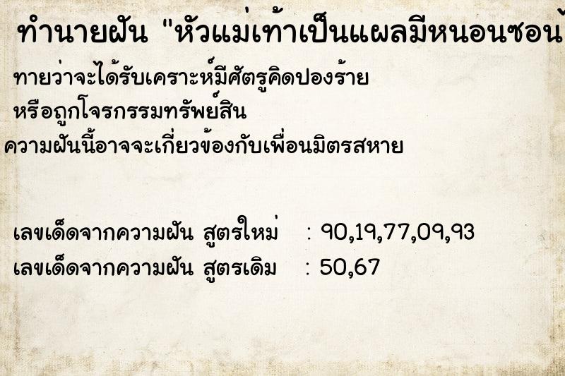 ทำนายฝันหัวแม่เท้าเป็นแผลมีหนอนซอนไซ ทำนายฝันทำนายฝันหัวแม่เท้าเป็นแผลมีหนอนซอนไซ