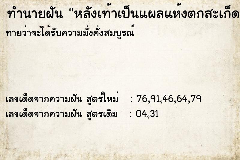 ทำนายฝันทำนายฝันหลังเท้าเป็นแผลแห้งตกสะเก็ด