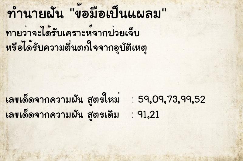 ทำนายฝันทำนายฝันข้อมือเป็นแผลม