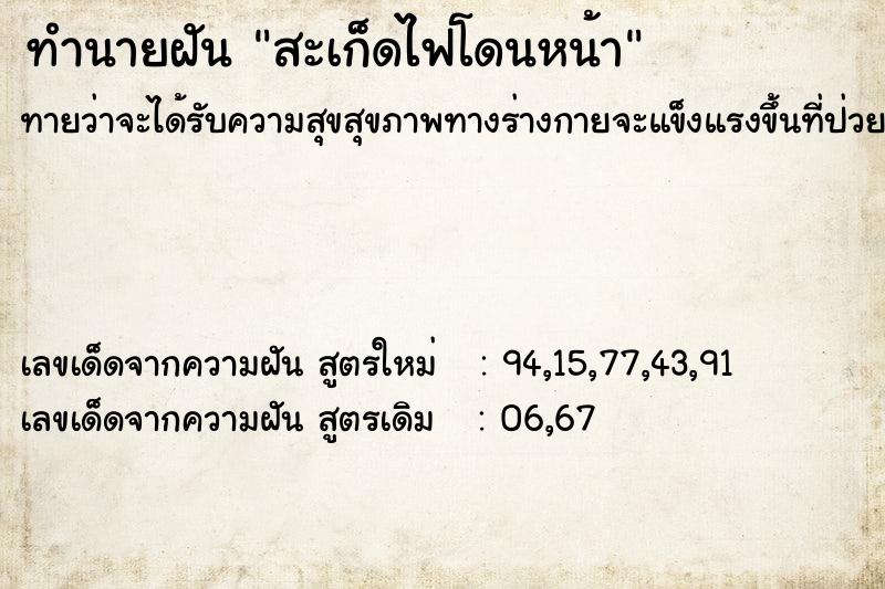 ทำนายฝันทำนายฝันสะเก็ดไฟโดนหน้า