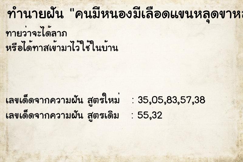 ทำนายฝัน คนมีหนองมีเลือดแขนหลุดขาหลุด